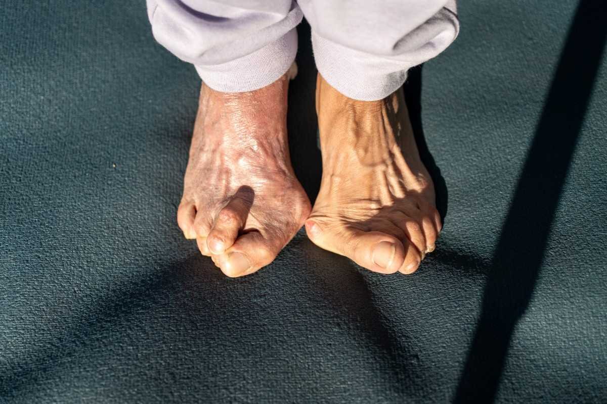 Gait Training